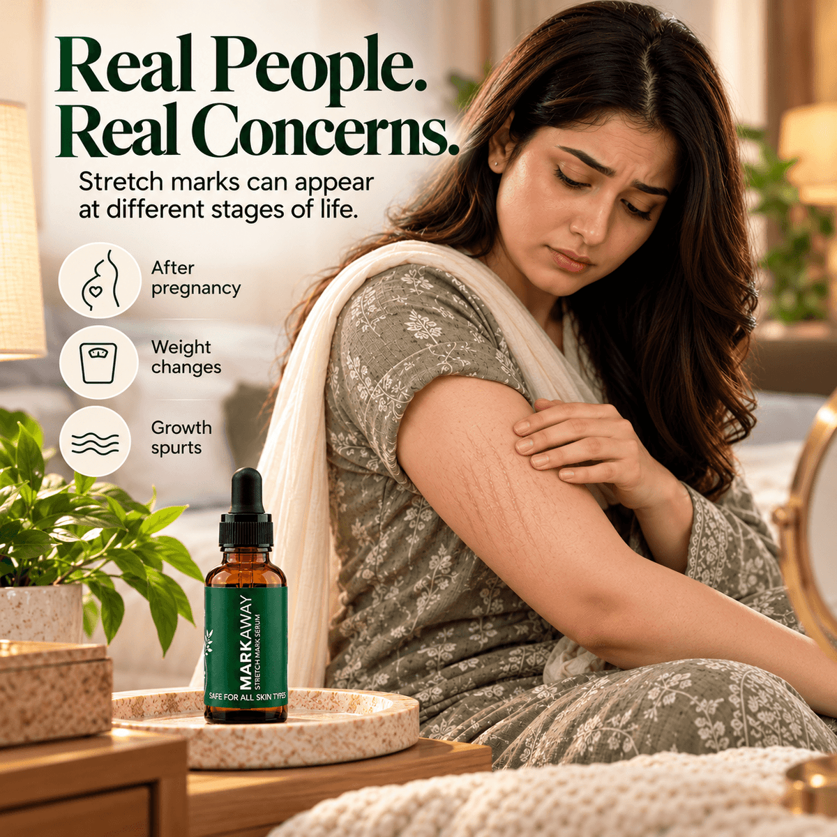 MARKAWAY Stretch Mark Serum